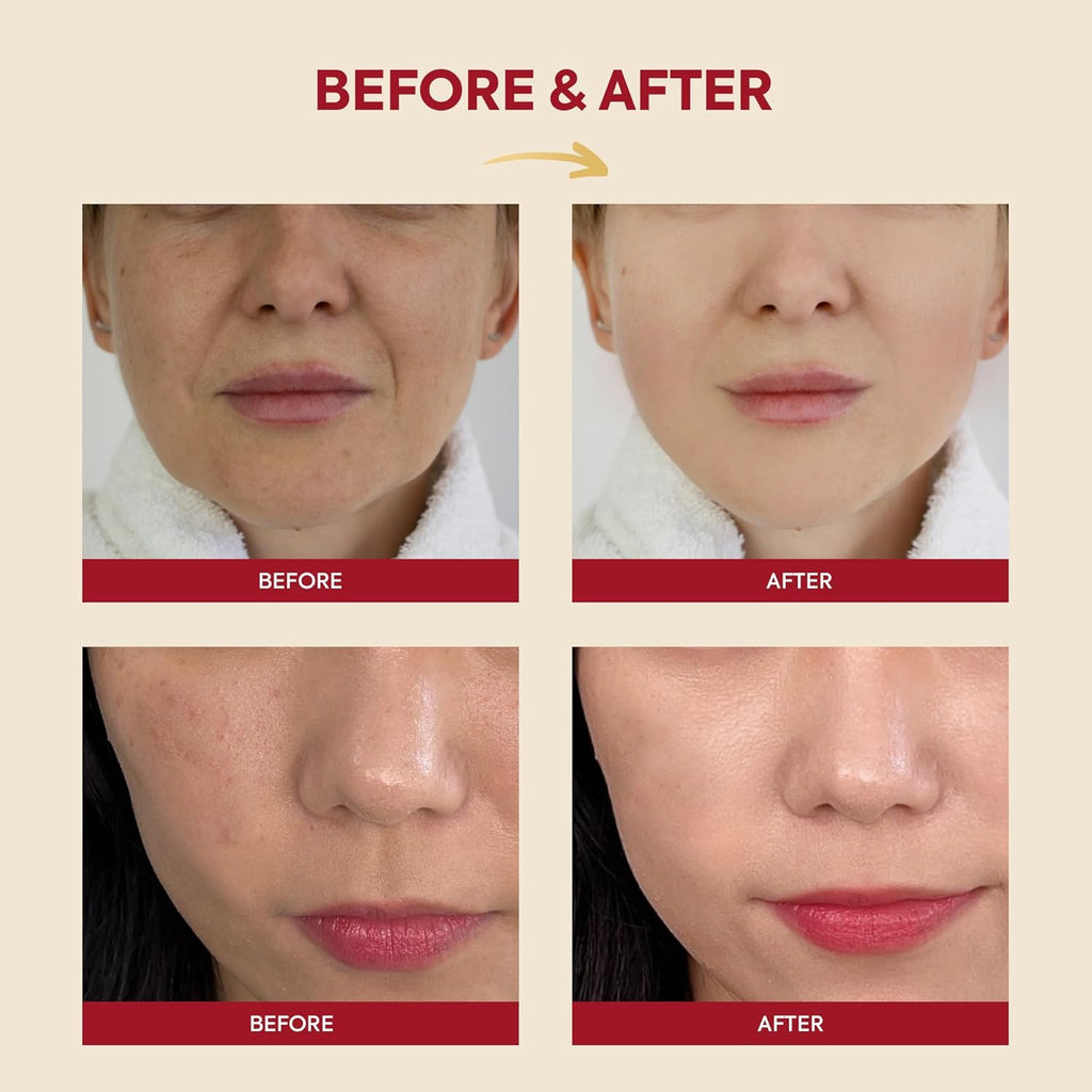 SEOUL 1988 Snail Mucin 97% Essence – Concentrated yet Lightweight Formula Infused with 97% Snail Mucin | Soothing & Fast-Absorption Facial Serum | Korean Skincare, 100Ml / 3.38 Fl Oz